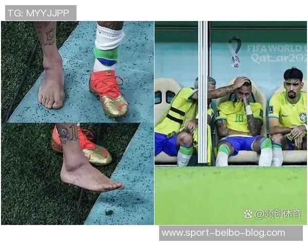 巴西媒体称内马尔旧伤复发游轮狂欢引发关注